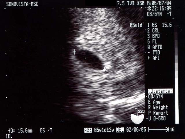 �D�P5�T0��